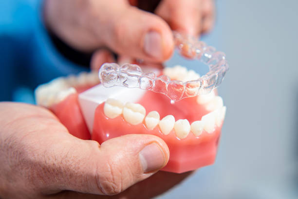 İnvisalign Şeffaf Plak Ne İşe Yarar Şeffaf Plak Tedavisi Fiyatları